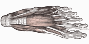 PLANTAR FASCIITIS