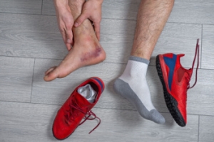 Regaining Strength After an Ankle Sprain