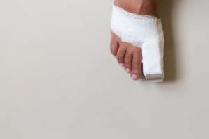 Surgery for Big-Toe Bone Spurs