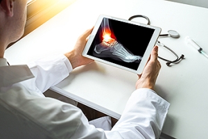 Ankle Avulsion Fracture and Recovery Expectations